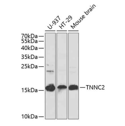 Western Blot - Anti-TNNC2 Antibody (A15865) - Antibodies.com