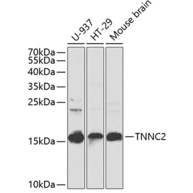 Western Blot - Anti-TNNC2 Antibody (A15865) - Antibodies.com