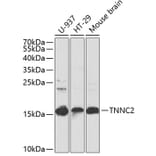 Western Blot - Anti-TNNC2 Antibody (A15865) - Antibodies.com