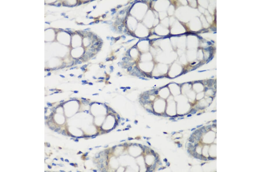 Immunohistochemistry - Anti-TNNC2 Antibody (A15865) - Antibodies.com