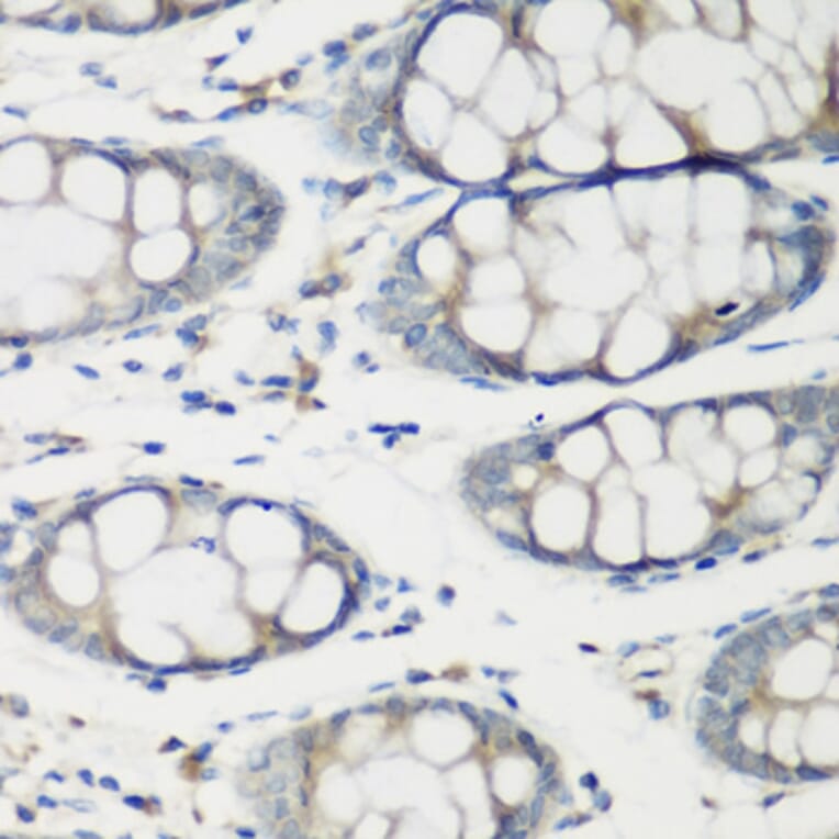 Immunohistochemistry - Anti-TNNC2 Antibody (A15865) - Antibodies.com