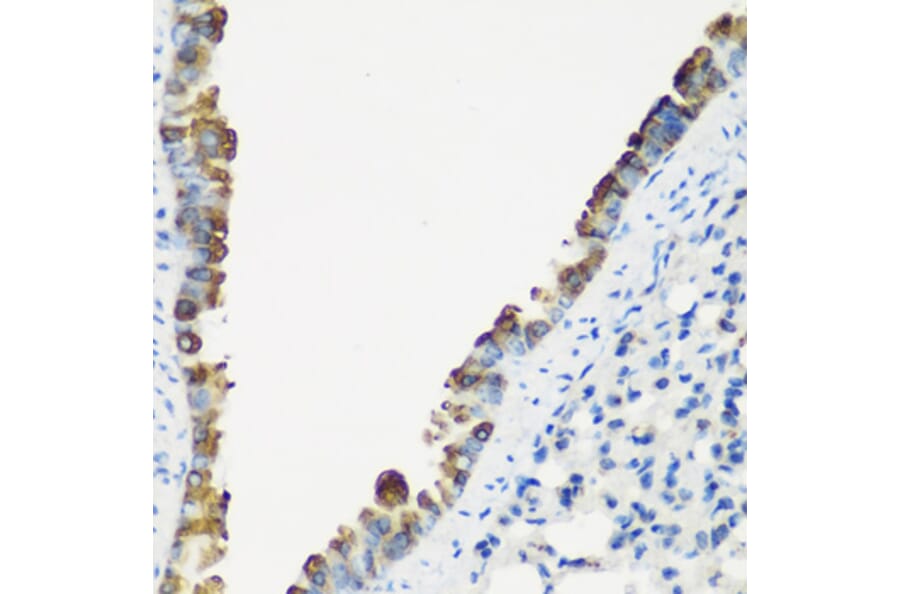 Immunohistochemistry - Anti-TNNC2 Antibody (A15865) - Antibodies.com