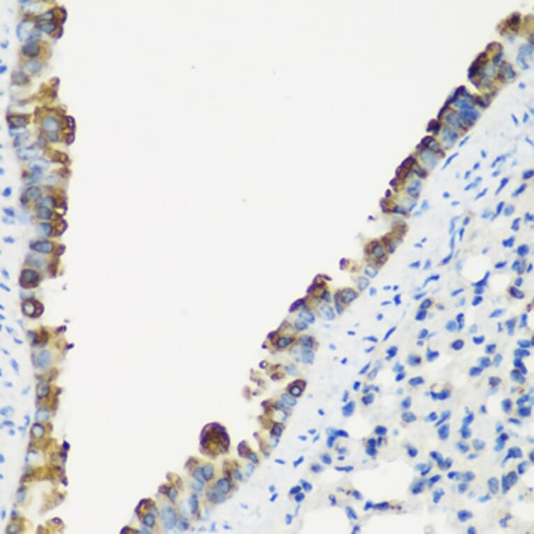 Immunohistochemistry - Anti-TNNC2 Antibody (A15865) - Antibodies.com