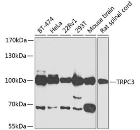 Western Blot - Anti-TRPC3 Antibody (A15866) - Antibodies.com