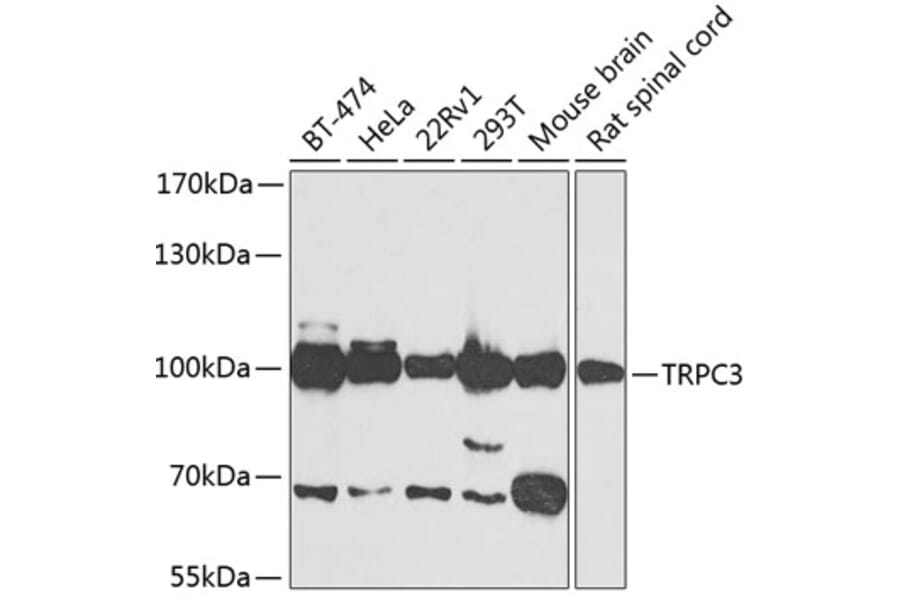 Western Blot - Anti-TRPC3 Antibody (A15866) - Antibodies.com