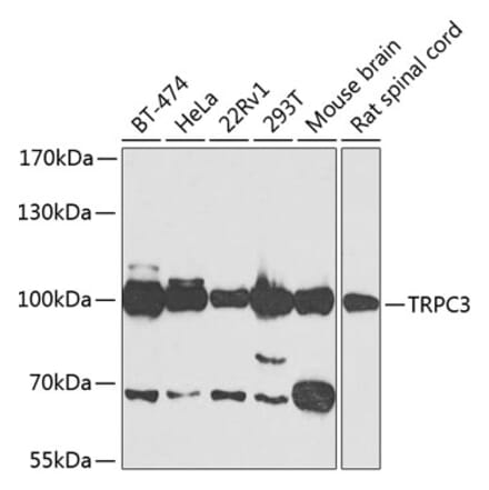 Western Blot - Anti-TRPC3 Antibody (A15866) - Antibodies.com