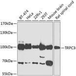 Western Blot - Anti-TRPC3 Antibody (A15866) - Antibodies.com