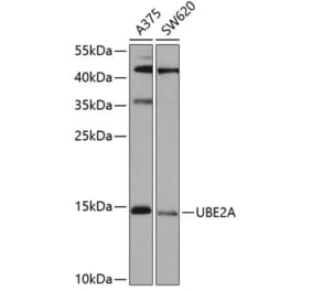 Western Blot - Anti-Rad6 Antibody (A15867) - Antibodies.com
