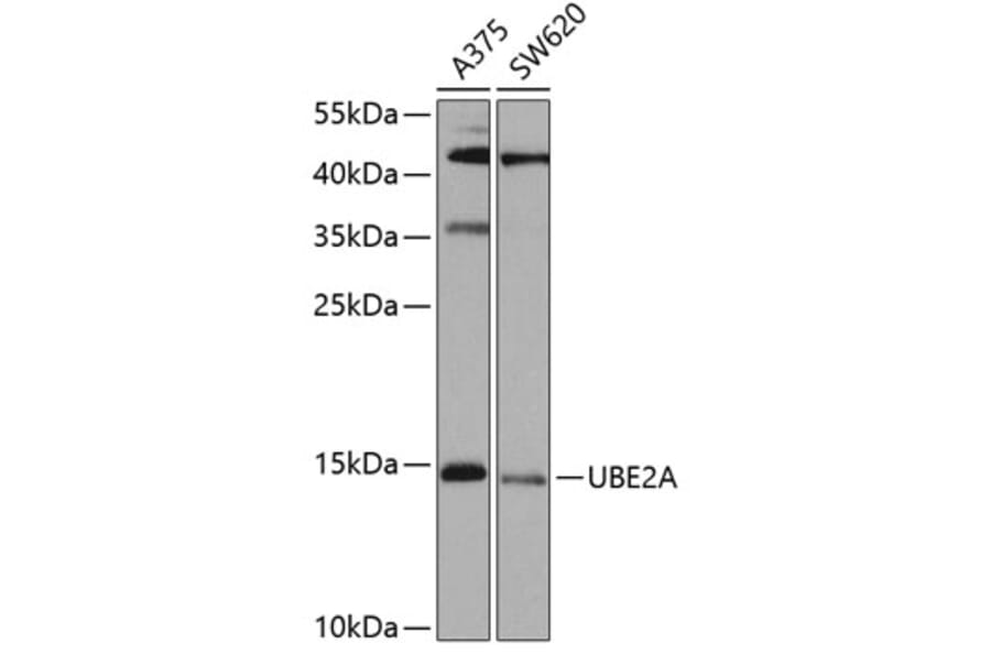 Western Blot - Anti-Rad6 Antibody (A15867) - Antibodies.com