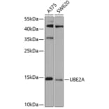 Western Blot - Anti-Rad6 Antibody (A15867) - Antibodies.com