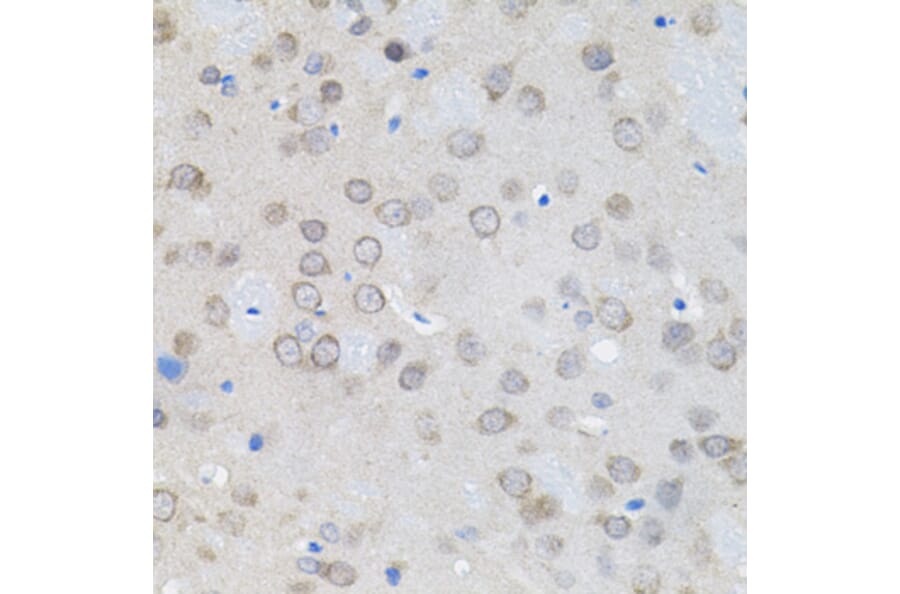 Immunohistochemistry - Anti-Rad6 Antibody (A15867) - Antibodies.com