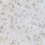 Immunohistochemistry - Anti-Rad6 Antibody (A15867) - Antibodies.com