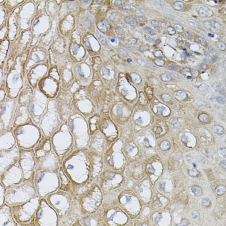 Immunohistochemistry - Anti-Rad6 Antibody (A15867) - Antibodies.com
