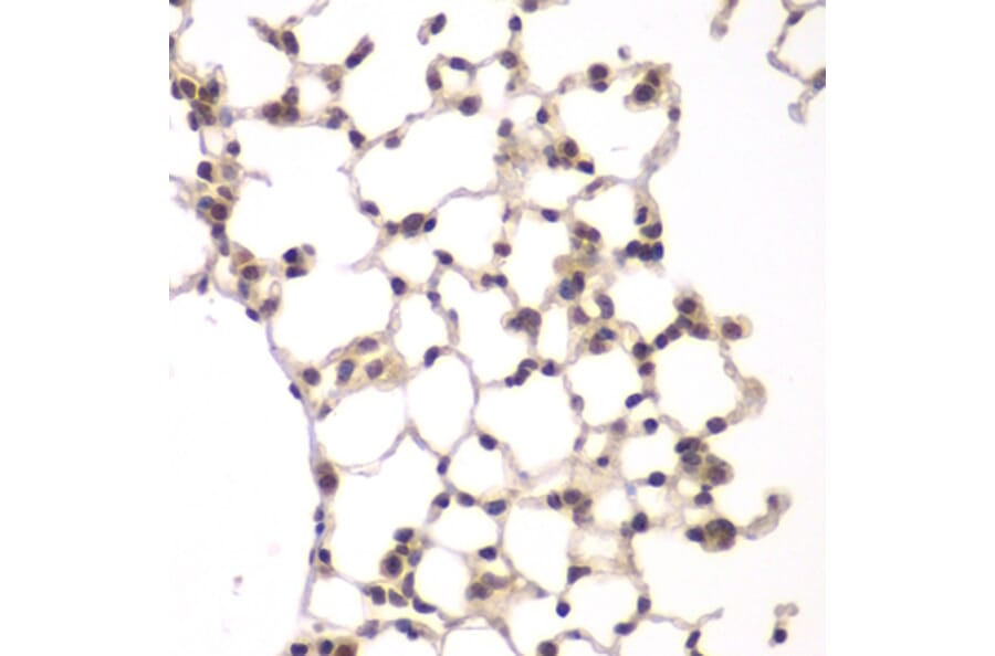 Immunohistochemistry - Anti-VRK1 Antibody (A15868) - Antibodies.com