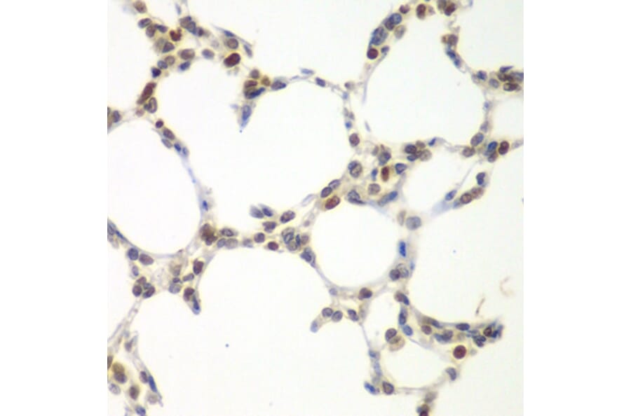 Immunohistochemistry - Anti-VRK1 Antibody (A15868) - Antibodies.com