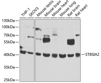 Western blot analysis of extracts of various cell lines, using Anti-ST8SIA2 Antibody (A7748) at 1:1,000 dilution.
Secondary antibody: Goat Anti-Rabbit IgG (H+L) (HRP) (AS014) at 1:10,000 dilution.
Lysates / proteins: 25µg per lane.
Blocking buffer: 3% non-fat dry milk in TBST.
Detection: ECL Basic Kit (RM00020).
Exposure time: 30s.