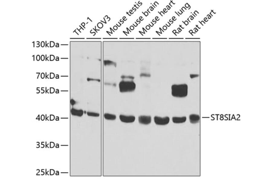 Western Blot - Anti-ST8SIA2 Antibody (A15870) - Antibodies.com