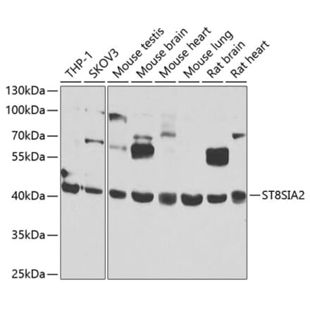 Western Blot - Anti-ST8SIA2 Antibody (A15870) - Antibodies.com