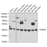 Western Blot - Anti-ST8SIA2 Antibody (A15870) - Antibodies.com