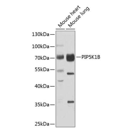 Western Blot - Anti-PIP5K1 beta Antibody (A15871) - Antibodies.com