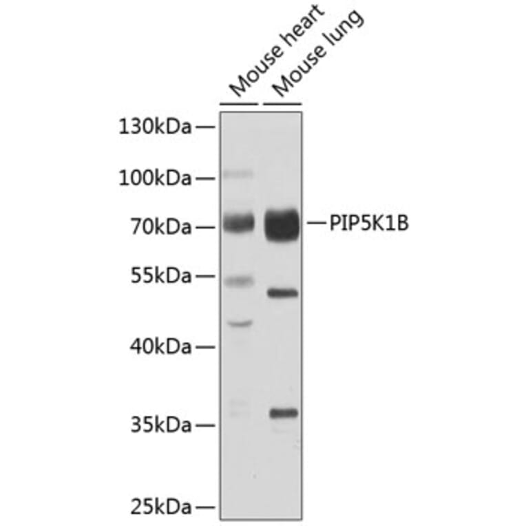 Western Blot - Anti-PIP5K1 beta Antibody (A15871) - Antibodies.com