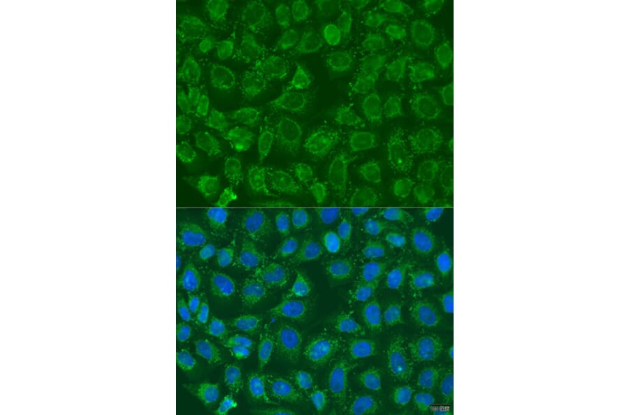 Immunofluorescence - Anti-PIP5K1 beta Antibody (A15871) - Antibodies.com