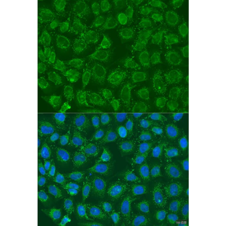 Immunofluorescence - Anti-PIP5K1 beta Antibody (A15871) - Antibodies.com