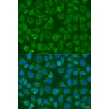 Immunofluorescence - Anti-PIP5K1 beta Antibody (A15871) - Antibodies.com