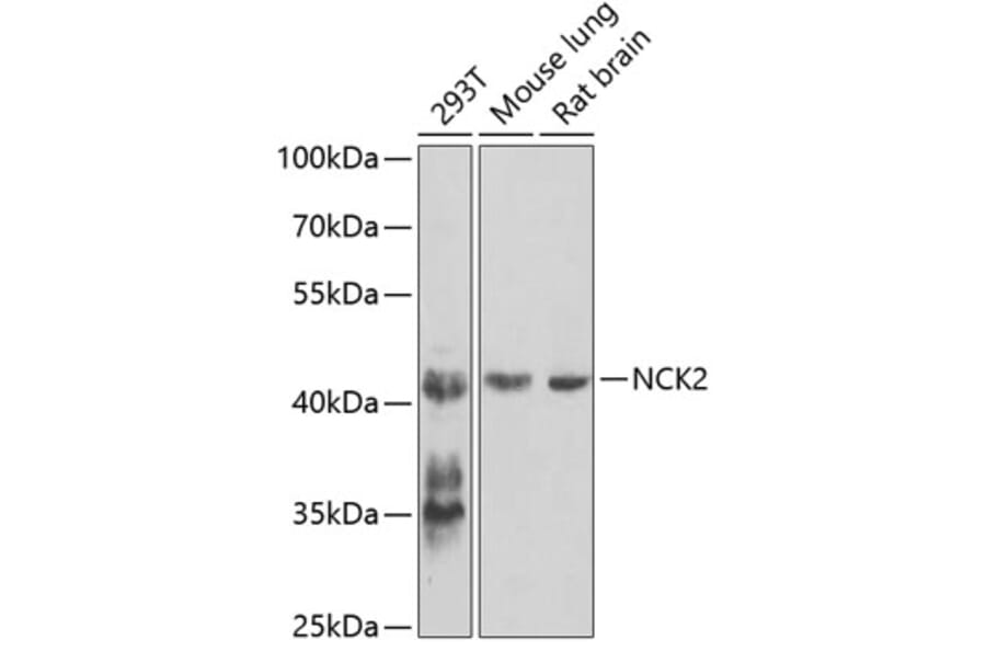 Western Blot - Anti-Nck-2 Antibody (A15872) - Antibodies.com