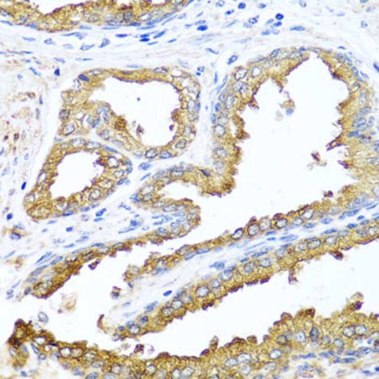Immunohistochemistry - Anti-Nck-2 Antibody (A15872) - Antibodies.com