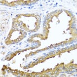 Immunohistochemistry - Anti-Nck-2 Antibody (A15872) - Antibodies.com
