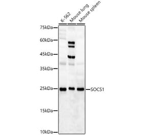 Western Blot - Anti-SOCS1 Antibody (A15873) - Antibodies.com