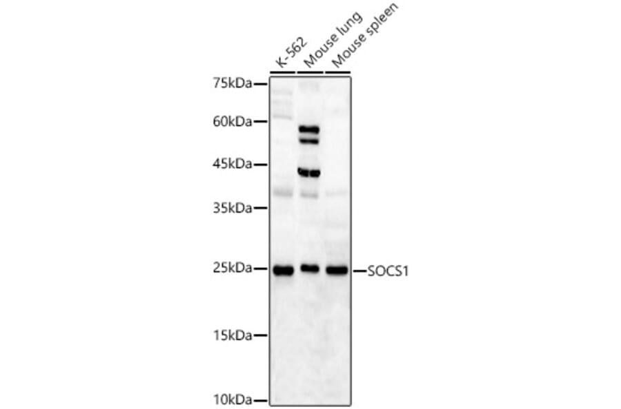 Western Blot - Anti-SOCS1 Antibody (A15873) - Antibodies.com