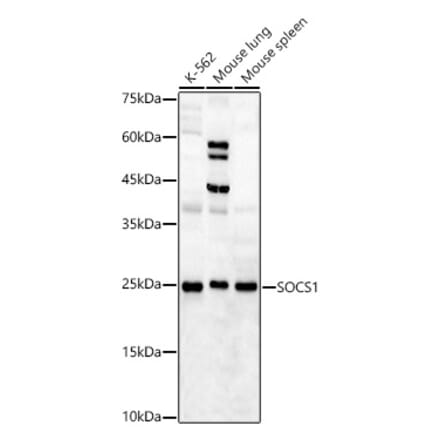 Western Blot - Anti-SOCS1 Antibody (A15873) - Antibodies.com
