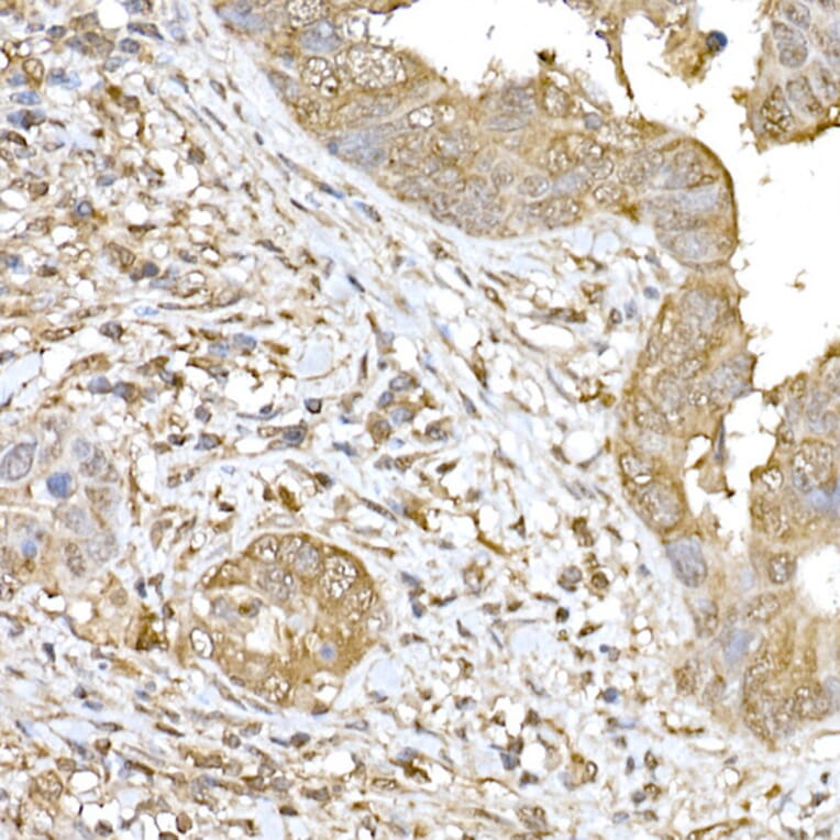 Immunohistochemistry - Anti-SOCS1 Antibody (A15873) - Antibodies.com