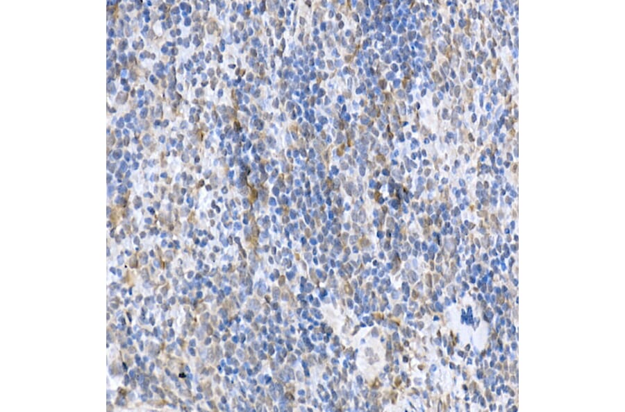 Immunohistochemistry - Anti-SOCS1 Antibody (A15873) - Antibodies.com