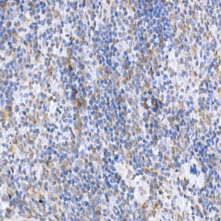 Immunohistochemistry - Anti-SOCS1 Antibody (A15873) - Antibodies.com
