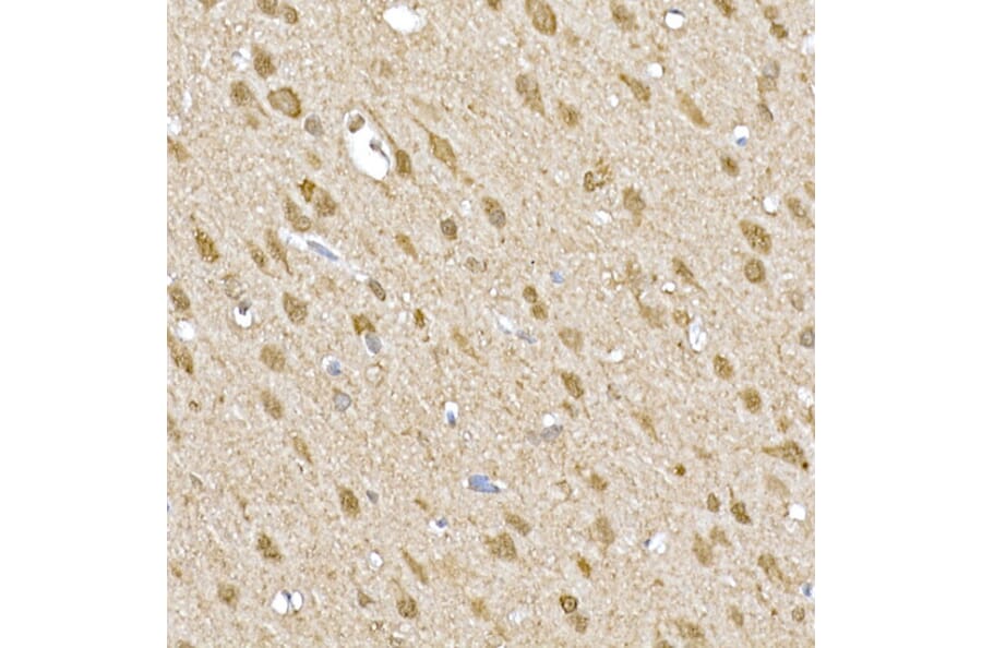 Immunohistochemistry - Anti-SOCS1 Antibody (A15873) - Antibodies.com