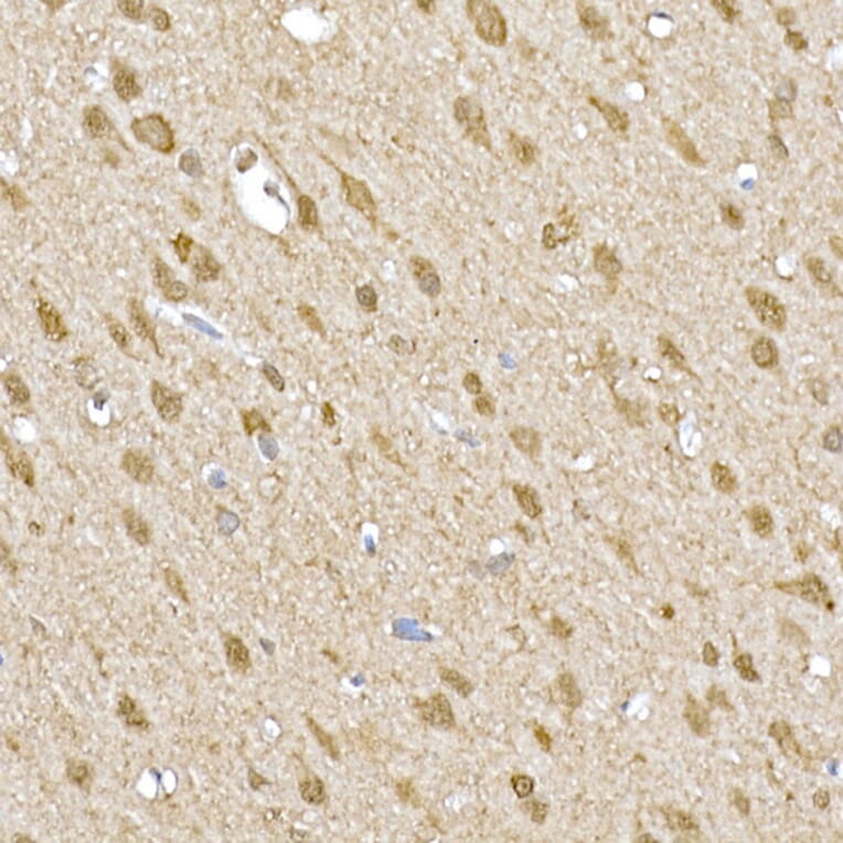 Immunohistochemistry - Anti-SOCS1 Antibody (A15873) - Antibodies.com