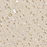 Immunohistochemistry - Anti-SOCS1 Antibody (A15873) - Antibodies.com