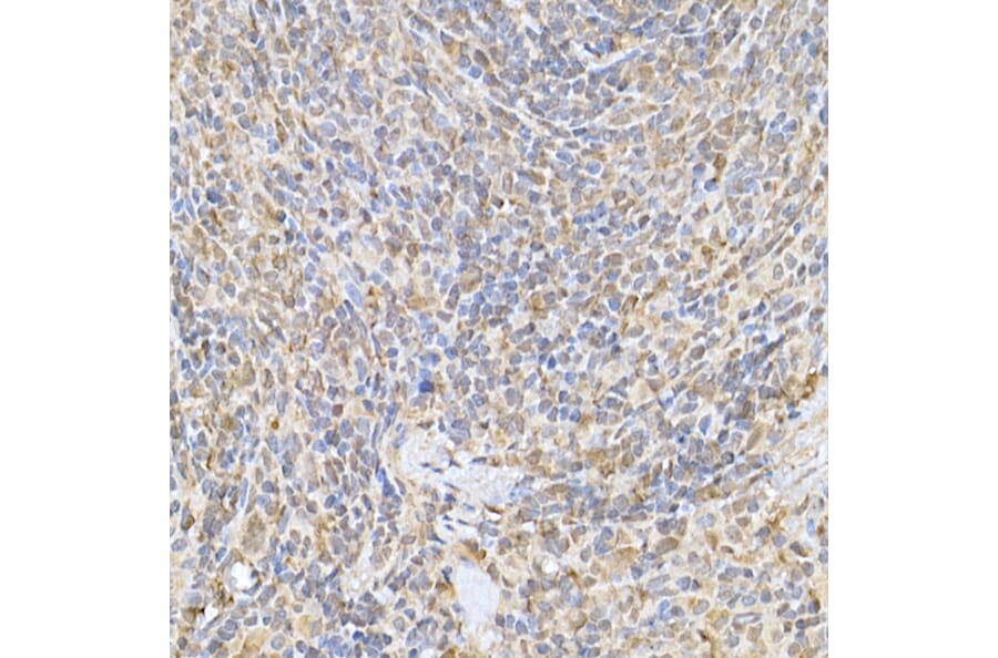 Immunohistochemistry - Anti-SOCS1 Antibody (A15873) - Antibodies.com
