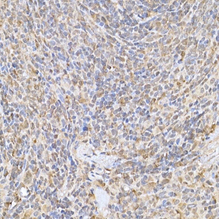 Immunohistochemistry - Anti-SOCS1 Antibody (A15873) - Antibodies.com