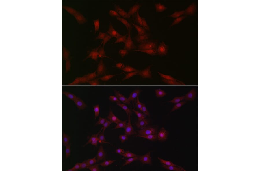 Immunofluorescence - Anti-SOCS1 Antibody (A15873) - Antibodies.com