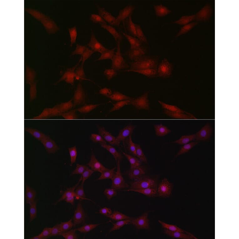 Immunofluorescence - Anti-SOCS1 Antibody (A15873) - Antibodies.com