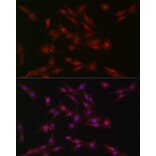 Immunofluorescence - Anti-SOCS1 Antibody (A15873) - Antibodies.com