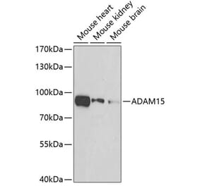 Western Blot - Anti-ADAM15 Antibody (A15874) - Antibodies.com