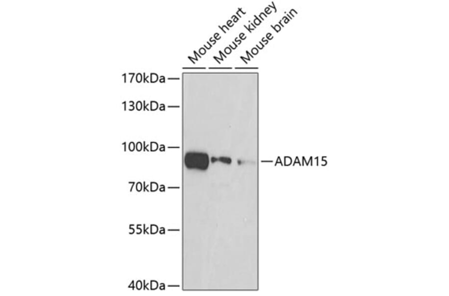 Western Blot - Anti-ADAM15 Antibody (A15874) - Antibodies.com