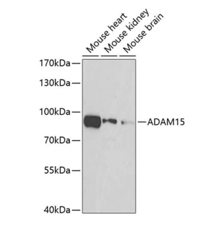 Western Blot - Anti-ADAM15 Antibody (A15874) - Antibodies.com