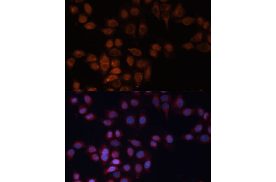 Immunofluorescence - Anti-ADAM15 Antibody (A15874) - Antibodies.com