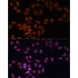 Immunofluorescence - Anti-ADAM15 Antibody (A15874) - Antibodies.com